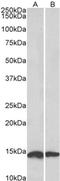 NADH:Ubiquinone Oxidoreductase Subunit S6 antibody, orb20602, Biorbyt, Western Blot image 