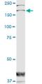 Dedicator Of Cytokinesis 1 antibody, H00001793-M02, Novus Biologicals, Western Blot image 