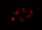 ERBB2 antibody, GTX03358, GeneTex, Immunofluorescence image 