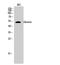 Desmin antibody, STJ92691, St John