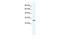 Chloride Intracellular Channel 1 antibody, GTX48722, GeneTex, Western Blot image 