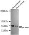 Integrin Subunit Beta 3 antibody, MBS475052, MyBioSource, Western Blot image 