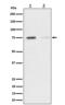 Mitogen-Activated Protein Kinase Kinase Kinase 7 antibody, P01458, Boster Biological Technology, Western Blot image 