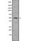 Eukaryotic Translation Initiation Factor 5 antibody, abx215125, Abbexa, Western Blot image 