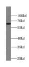 McKusick-Kaufman Syndrome antibody, FNab00821, FineTest, Western Blot image 