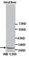 Kallikrein Related Peptidase 14 antibody, orb77153, Biorbyt, Western Blot image 