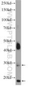 Transmembrane Protein 182 antibody, 25366-1-AP, Proteintech Group, Western Blot image 