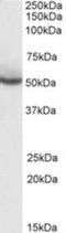 Peroxisome Proliferator Activated Receptor Delta antibody, NB300-962, Novus Biologicals, Western Blot image 