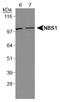Nibrin antibody, NBP1-06705, Novus Biologicals, Western Blot image 