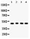 C-Terminal Binding Protein 1 antibody, PB9425, Boster Biological Technology, Western Blot image 