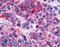 Calcitonin Receptor antibody, LS-A766, Lifespan Biosciences, Immunohistochemistry paraffin image 