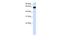 Phosphatidylinositol Glycan Anchor Biosynthesis Class T antibody, A08828, Boster Biological Technology, Western Blot image 