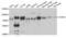 Ataxin 1 antibody, abx004749, Abbexa, Western Blot image 
