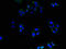 Actin Binding LIM Protein 1 antibody, LS-C498268, Lifespan Biosciences, Immunofluorescence image 