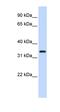 Protein O-Mannose Kinase antibody, orb325541, Biorbyt, Western Blot image 