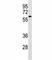 Interleukin 1 Receptor Associated Kinase 4 antibody, F42537-0.4ML, NSJ Bioreagents, Western Blot image 