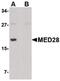 Mediator Complex Subunit 28 antibody, PA5-20572, Invitrogen Antibodies, Western Blot image 