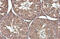 Paxillin antibody, GTX633633, GeneTex, Immunohistochemistry paraffin image 