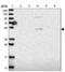 Solute Carrier Family 10 Member 5 antibody, NBP1-85965, Novus Biologicals, Western Blot image 