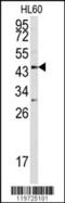 Asporin antibody, 62-356, ProSci, Western Blot image 