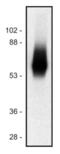 T Cell Receptor Associated Transmembrane Adaptor 1 antibody, LS-C45986, Lifespan Biosciences, Western Blot image 