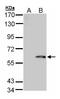 FPGS antibody, PA5-27914, Invitrogen Antibodies, Western Blot image 