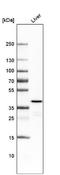 Ornithine Carbamoyltransferase antibody, NBP2-59040, Novus Biologicals, Western Blot image 