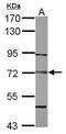 Dystrobrevin Beta antibody, GTX108710, GeneTex, Western Blot image 