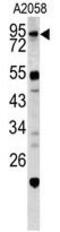 Caldesmon 1 antibody, GTX81812, GeneTex, Western Blot image 
