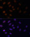 Lysine Acetyltransferase 2A antibody, 18-583, ProSci, Immunofluorescence image 
