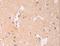 Adenylate Cyclase 1 antibody, LS-C402870, Lifespan Biosciences, Immunohistochemistry paraffin image 