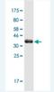 Mitogen-activated protein kinase kinase kinase kinase 1 antibody, H00011184-M02-100ug, Novus Biologicals, Western Blot image 