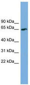 TBC1 Domain Family Member 24 antibody, TA344770, Origene, Western Blot image 
