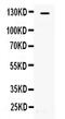 ATP Citrate Lyase antibody, PA5-78712, Invitrogen Antibodies, Western Blot image 