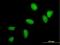 UBE2C antibody, H00011065-M04, Novus Biologicals, Immunofluorescence image 