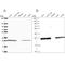 Triosephosphate Isomerase 1 antibody, NBP2-58150, Novus Biologicals, Western Blot image 