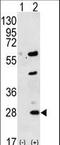 Gremlin 1, DAN Family BMP Antagonist antibody, LS-C166665, Lifespan Biosciences, Western Blot image 