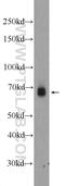 EYA Transcriptional Coactivator And Phosphatase 4 antibody, 24691-1-AP, Proteintech Group, Western Blot image 