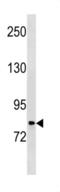 Procollagen-Lysine,2-Oxoglutarate 5-Dioxygenase 2 antibody, abx034642, Abbexa, Western Blot image 