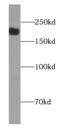 Clathrin Heavy Chain Like 1 antibody, FNab01779, FineTest, Western Blot image 