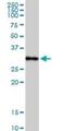 Complement C1q A Chain antibody, H00000712-D01, Novus Biologicals, Western Blot image 