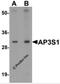 Adaptor Related Protein Complex 3 Subunit Sigma 1 antibody, 6391, ProSci, Western Blot image 