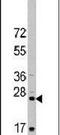 CD8 antibody, PA5-11453, Invitrogen Antibodies, Western Blot image 