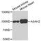 N-Acylsphingosine Amidohydrolase 2 antibody, A04725-1, Boster Biological Technology, Western Blot image 