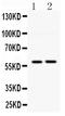 Diacylglycerol O-Acyltransferase 1 antibody, PB9801, Boster Biological Technology, Western Blot image 