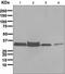 Thymidylate Synthetase antibody, ab108995, Abcam, Western Blot image 