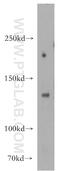 Histone Deacetylase 6 antibody, 16167-1-AP, Proteintech Group, Western Blot image 