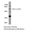 Solute Carrier Family 22 Member 6 antibody, LS-C177615, Lifespan Biosciences, Western Blot image 