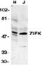 Death Associated Protein Kinase 3 antibody, PA1-30693, Invitrogen Antibodies, Western Blot image 