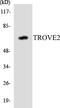 Ro60, Y RNA Binding Protein antibody, LS-B14711, Lifespan Biosciences, Western Blot image 